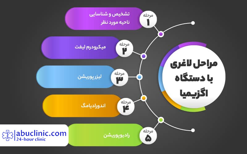 لاغری با دستگاه اگزیمیا بدون جراحی + مزایا و معایب